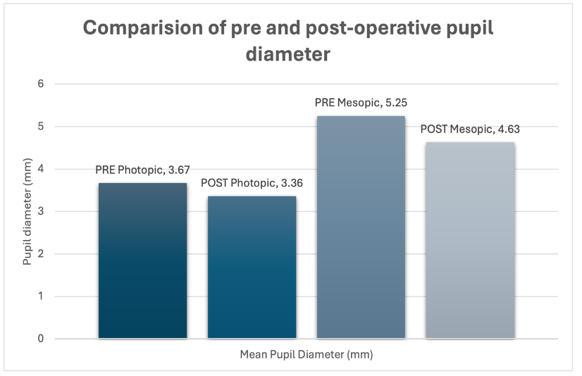 Figure 2: Comparison of pre and post-operative pupil diameter.