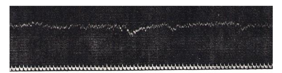 Fig. 5. The first registration of the electrical brain activity (‘Elektrocerebrogramm’) of dogs made by Wladimir Práwdicz-Neminski in 1913. The lower trace is the time in seconds (5 units is 1 sec). The recording has a dominant frequency of 12 to 14 Hz.