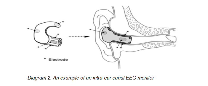 Diagram 2: An example of an intra-ear canal EEG monitor
