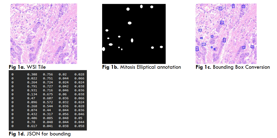 Fig 1a. WSI Tile Fig 1b. Mitosis Elliptical annotation Fig 1c. Bounding Box Conversion Fig 1d. JSON for bounding