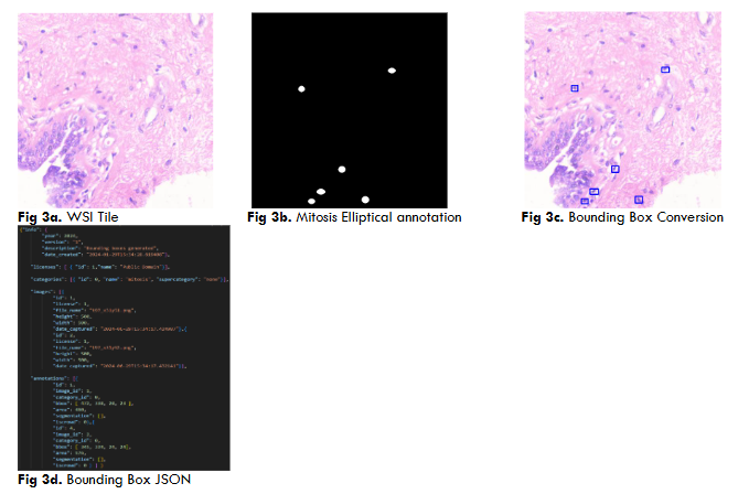 Fig 3a. WSI Tile Fig 3b. Mitosis Elliptical annotation Fig 3c. Bounding Box Conversion Fig 3d. Bounding Box JSON