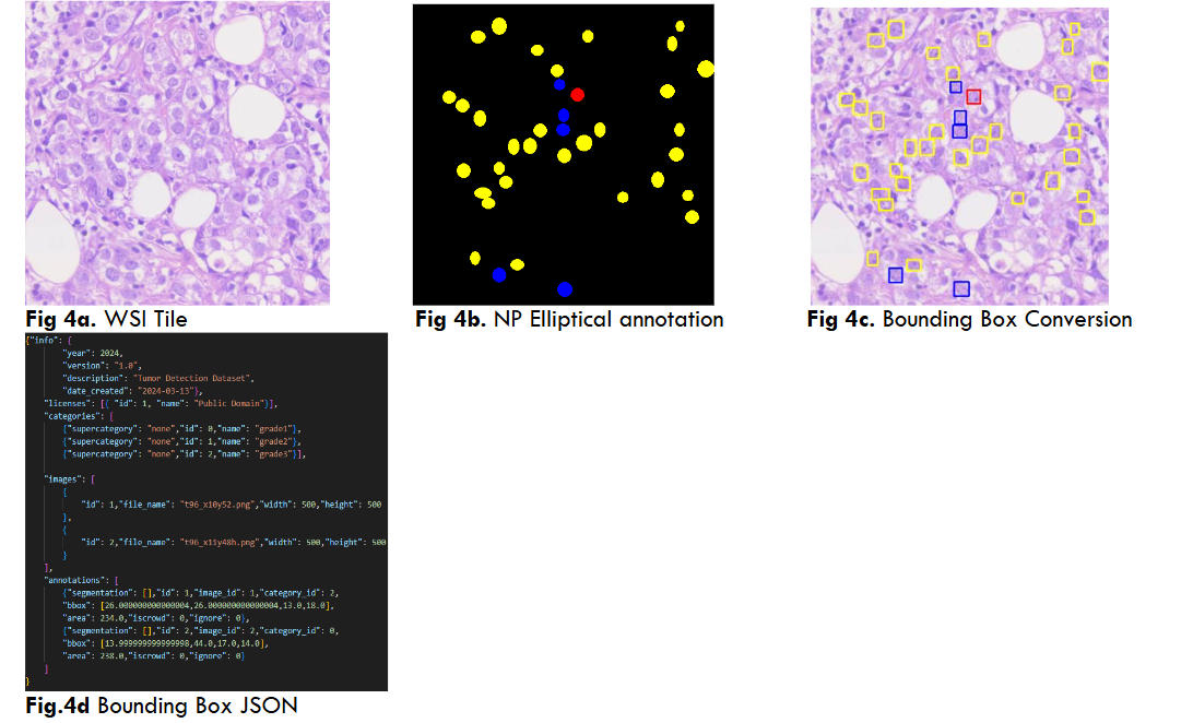 Fig 4a. WSI Tile Fig 4b. NP Elliptical annotation Fig 4c. Bounding Box Conversion Fig 4d. Bounding Box JSON