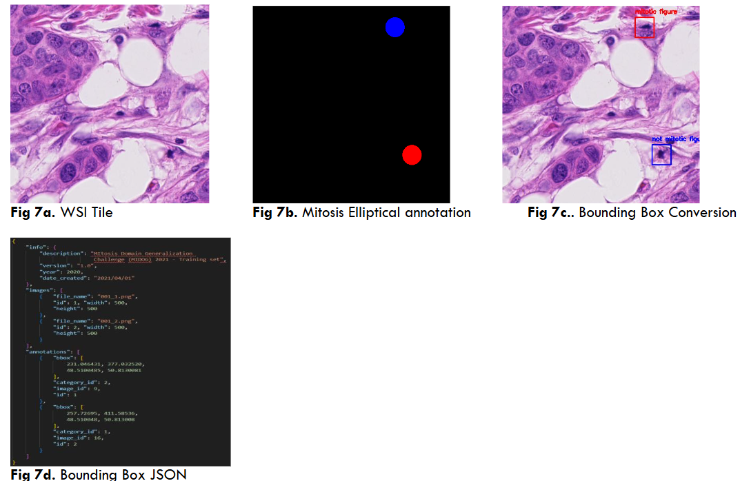 Fig 8a. WSI Tile Fig 8b. Tumor/Non-Tumor annotation Fig 8c. Bounding Box Conversion Fig 8d. Bounding Box JSON