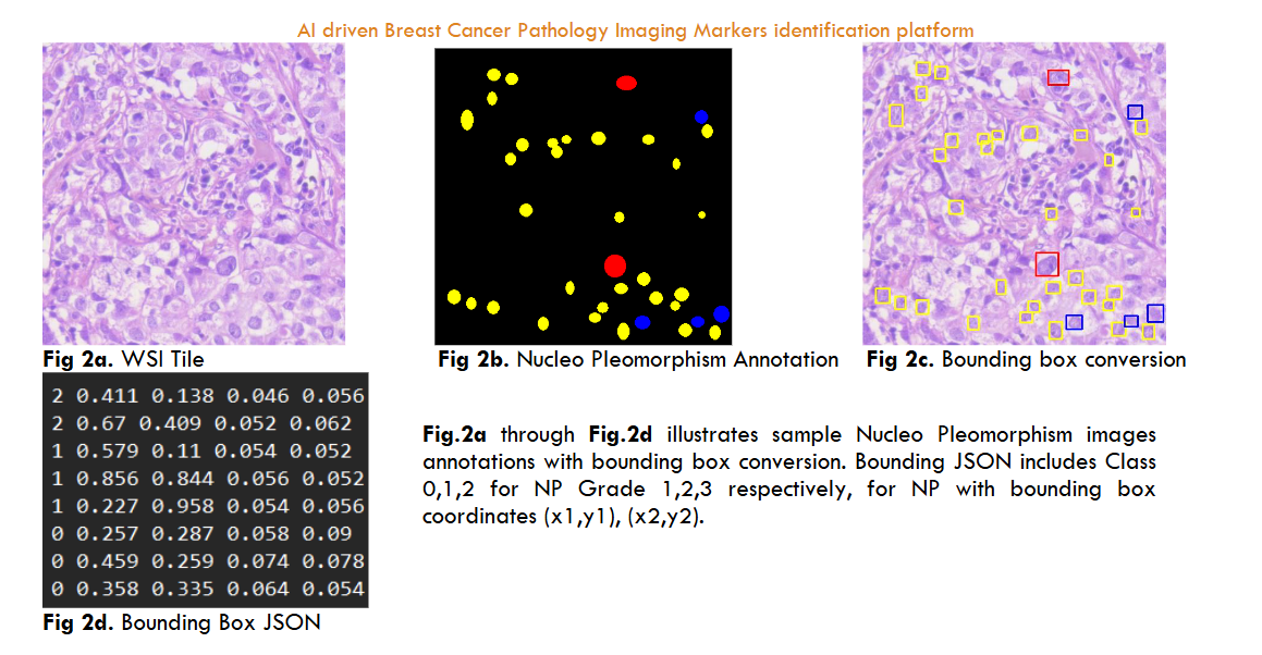 Fig 2a. WSI Tile Fig 2b. Nucleo Pleomorphism Annotation Fig 2c. Bounding box conversion Fig 2d. Bounding Box JSON