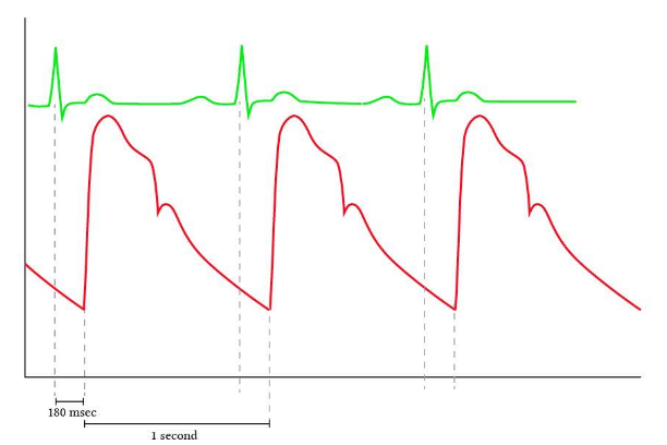 Timing correlation of the arterial pulse and the Electrocardiogram [taken from Yartsev, 2023]