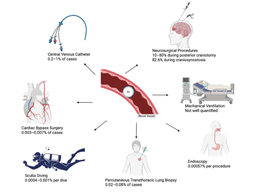 Central Figure- Figure Depicting The Incidence Of Common And Uncommon Causes Of Air Embolism.