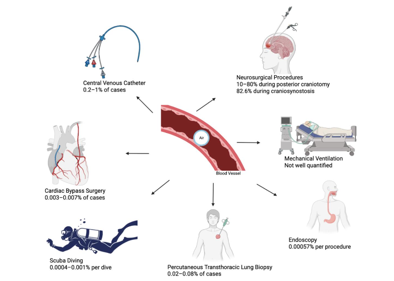 Central Figure- Figure Depicting The Incidence Of Common And Uncommon Causes Of Air Embolism.