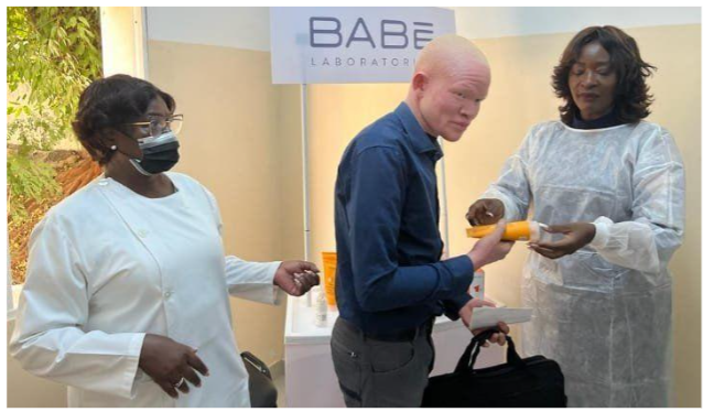 Fig. 3: An albino receiving medical assistance.