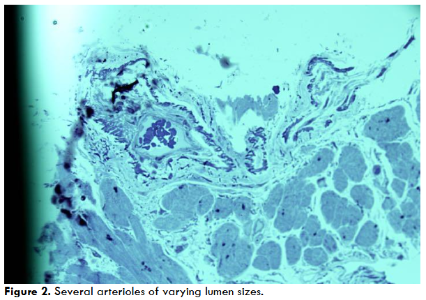 Figure 2. Several arterioles of varying lumen sizes.