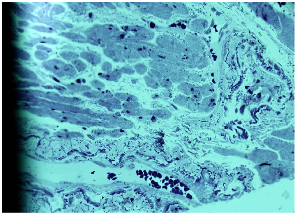 Figure 1. De novo formation in a large arteriole
