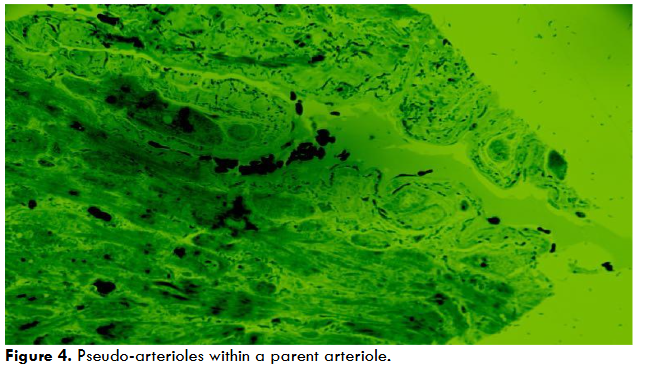 Figure 4. Pseudo-arterioles within a parent arteriole.