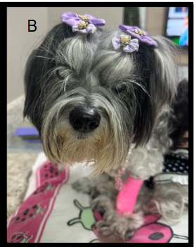 Figure I. Patient nowadays, at 18 years of age, after 4 years of treatment.