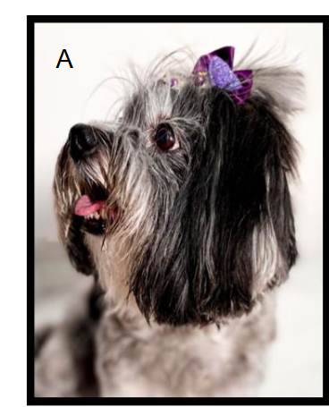 Figure I A. Patient at treatment initiation with 14 years old.