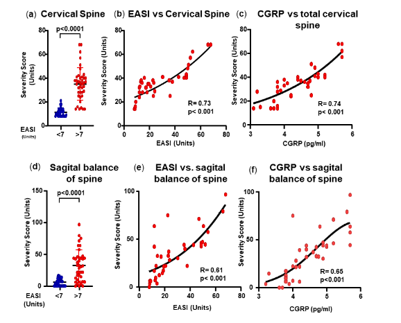 Figure 2. Cervical spine and sagittal balance of the spine. (a) Cervical spine severity score. (b) Correlation between cervical spine severity scores and EASI scores. (c) Correlation between cervical spine severity scores and CGRP levels. (d) Levels of sagittal balance of the spine. (e) Correlation between the levels of sagittal balance of the spine and EASI scores. (f) Correlation between the levels of sagittal balance of the spine and CGRP levels.