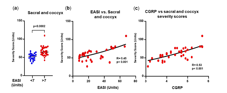 Figure 4. Coccyx and sacral spine. (a) Coccyx and sacral spine severity score. (b) Correlation between coccyx and sacral spine severity scores and EASI scores. (c) Correlation between coccyx and sacral spine severity scores and Calcitonin Gene-Related Peptide (CGRP) levels.