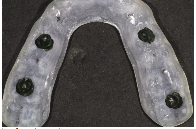 Note: Greenstick compound registration