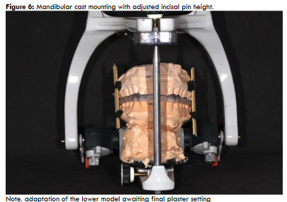 Figure 6: Mandibular cast mounting with adjusted incisal pin height. Note. adaptation of the lower model awaiting final plaster setting Source: author’s own