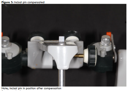 Figure 5: Incisal pin compensated Note; incisal pin in position after compensation Source: author’s own