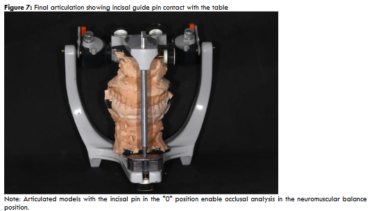 Figure 7: Final articulation showing incisal guide pin contact with the table Note: Articulated models with the incisal pin in the "0" position enable occlusal analysis in the neuromuscular balance position. Source: author’s own