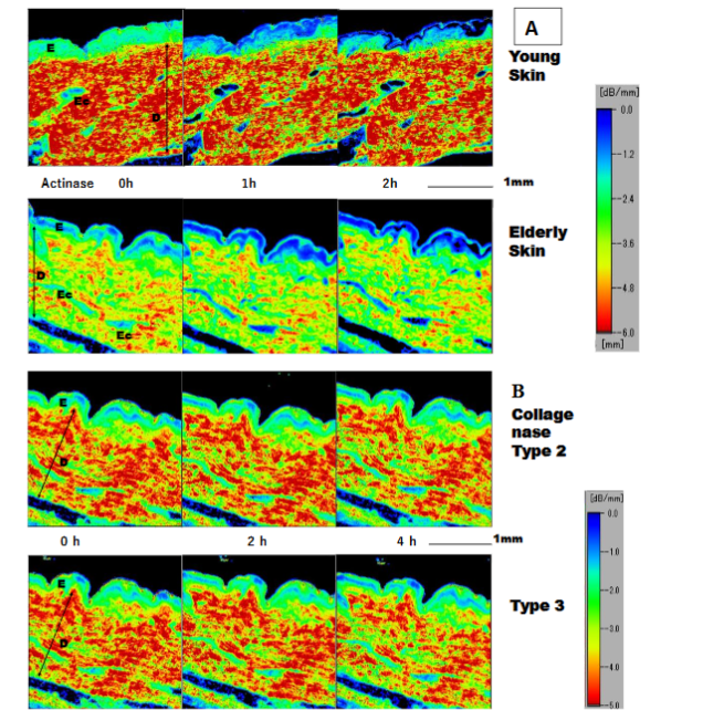 Fig. 3. Dermal attenuation-of-sound (AOS) values after collagenase types 2 and 3 digestion. A: Young skin, B: Elderly skin. Left: 0 h, middle: 2 h after digestion, right: 4 h after digestion. E: epidermis, D: dermis. AOS images of both young and elderly patients showed no remarkable changes over time. However, the dermis of the young group higher AOS values than did that of the elderly group.