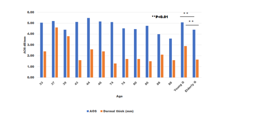 Fig. 2. Dermal attenuation-of-sound (AOS) values and thickness. AOS values of the dermal collagen layer were more remarkable in the young group than in the elderly group (p < 0.01). The dermis was thicker in the young group than in the elderly group (p < 0.01). AOS values were positively correlated with dermal thickness (p < 0.05).