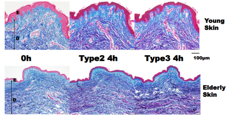 Fig. 4. Light microscopy (LM) images of the skin before and after collagenase types 2 and 3 digestion. Left: 0 h, middle: type 2 at 4 h after digestion, right: type 3 at 4 h after digestion. E: epidermis, D: dermis. Compared to the 0 h image, both type 2 and 3 images displayed no remarkable changes except for red thick collagen. The young group had a dermis richer in thick collagen fibers than did the elderly group. The elderly group had a thinner epidermis with flatter rete ridges than did the young group.