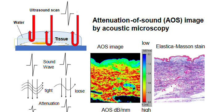 Fig. 1. Principles of the attenuation-of-sound (AOS) image. Sound waves irradiating from the transducer hit and return from the surface and bottom of the specimen. The waves lose more energy passing through tight fibrous tissues than it would be passing through loose tissues. Plotting the attenuation values from each point on the section creates a histological image in color code (e.g., from the breast skin at the center bottom). The color bar code presents the highest attenuation area in red and the lowest in blue, with the corresponding light microscopy image via Elastica–Masson staining presented at the bottom right.