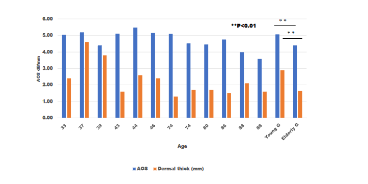 Fig. 2. Dermal attenuation-of-sound (AOS) values and thickness. AOS values of the dermal collagen layer were more remarkable in the young group than in the elderly group (p < 0.01). The dermis was thicker in the young group than in the elderly group (p < 0.01). AOS values were positively correlated with dermal thickness (p < 0.05).