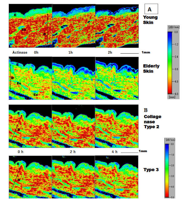 Fig. 3. Dermal attenuation-of-sound (AOS) values after collagenase types 2 and 3 digestion. A: Young skin, B: Elderly skin. Left: 0 h, middle: 2 h after digestion, right: 4 h after digestion. E: epidermis, D: dermis. AOS images of both young and elderly patients showed no remarkable changes over time. However, the dermis of the young group higher AOS values than did that of the elderly group.