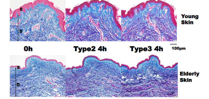 Fig. 4. Light microscopy (LM) images of the skin before and after collagenase types 2 and 3 digestion. Left: 0 h, middle: type 2 at 4 h after digestion, right: type 3 at 4 h after digestion. E: epidermis, D: dermis. Compared to the 0 h image, both type 2 and 3 images displayed no remarkable changes except for red thick collagen. The young group had a dermis richer in thick collagen fibers than did the elderly group. The elderly group had a thinner epidermis with flatter rete ridges than did the young group.