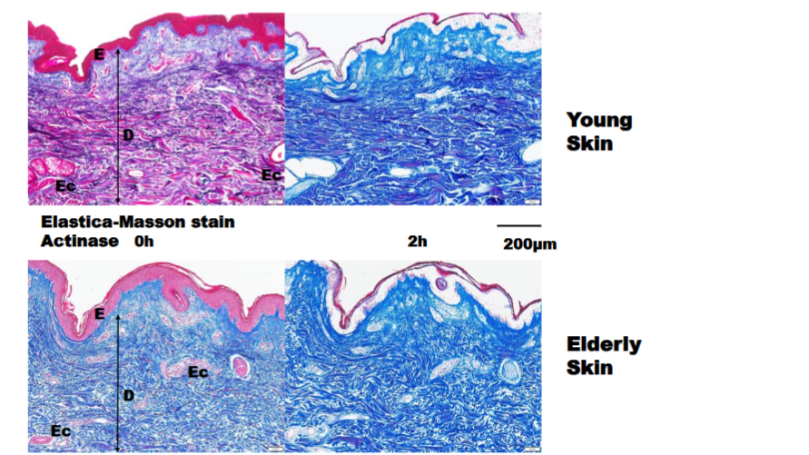 Fig. 9. Light microscopy (LM) image using Elastica–Masson staining before and after actinase digestion. LM images showed almost complete digestion of the epidermis, except the surface keratin layer. Dermal elastic fibers disappeared after digestion. Eccrine glands staining had become faint after digestion. E: epidermis, D: dermis, Ec: eccrine gland.