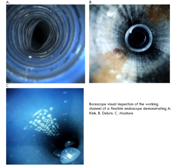 Borescope visual inspection of the working channel of a flexible endoscope demonstrating A: Kink. B. Debris. C. Moisture.