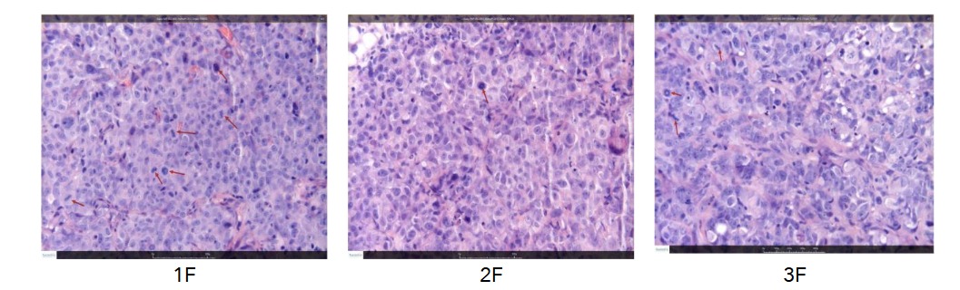 Figure 7. Histology (X40 field) of three tumors: 1F Vehicle, 2F ALAM027 1, 3F ALAM108 2.
