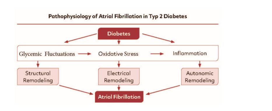 Figure 1: Pathophysiology of Atrial Fibrillation in type 2 Diabetes. Diabetes mediated Atrial Fibrillation is multifactorial encompassing Structural, Electrical and Autonomic Remodeling, Metabolic Dysfunction, Oxidative Stress and Inflammation.