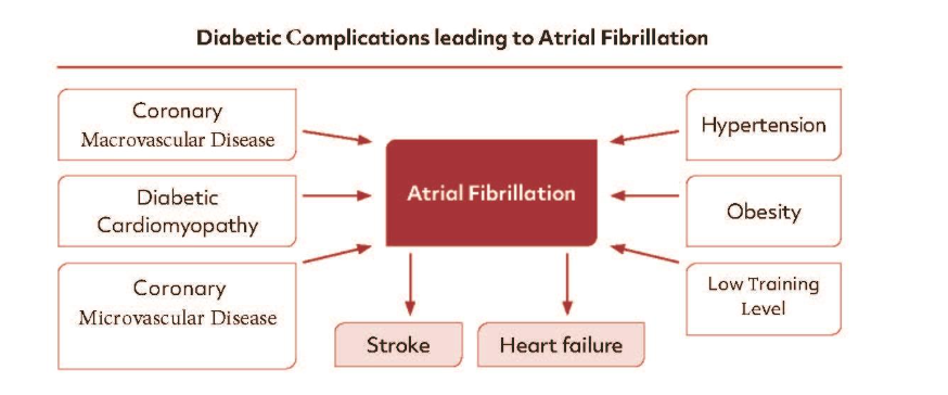 Figure 2: Diabetic Complications leading to Atrial Fibrillation are macrovascular coronary artery Disease, Diabetic Cardiomyopathy and Microvascular coronary artery Disease. Additionally, also noncardiac factors are known to favour the Induction of Atrial Fibrillation like Overweight, Hypertension and a Low Training Level. Potential complications of Atrial Fibrillation are stroke and heart failure.