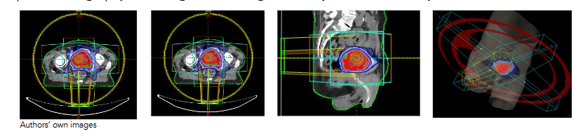 Figure 2, Treatment plan dose delivery pattern selected for this study.