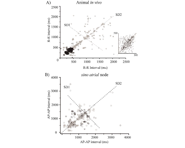 Figure 2. Metabolic syndrome changes the variability of the heart rhythm like aging. A) Poincare plot of ECG RR intervals decreased frequency and increased heart rate variability in MetS (n=15, grey; control n=15).