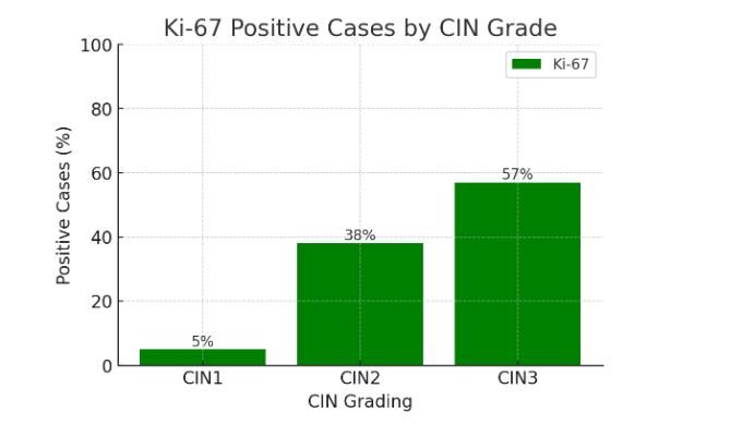 Figure 1: Bar chart showing the percentage of Ki-67 positive cases across different CIN grades (CIN1, CIN2, CIN3). Ki-67 expression compared in patients with CIN1 vs CIN2 and CIN2 vs CIN3. p<0.0001 in both cases.