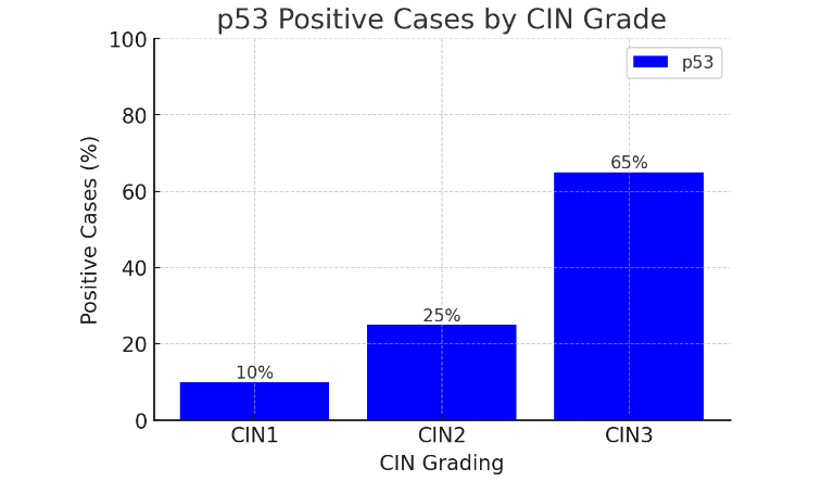 Figure 3: Bar chart showing the percentage of p53 positive cases across different CIN grades (CIN1, CIN2, CIN3). p53 expression compared in patients with CIN1 vs CIN2 and CIN2 vs CIN3. p<0.0001 in both cases.