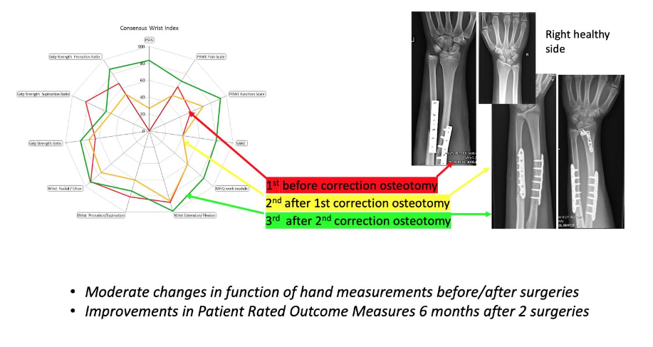 Figure 1a: The consensus wrist index for case 1.