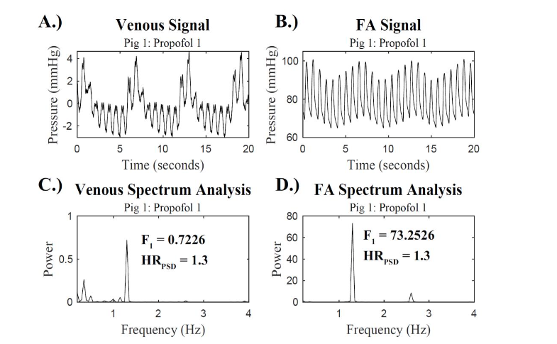 Figure 1: Time Domain and Spectrum Analysis Waveforms: A.) The venous pressure waveform and B.) the simultaneous FA pressure waveform for porcine subject 1 during Propofol 1. The corresponding power spectral densities are displayed for C.) the venous pressure waveform and D.) the FA pressure waveform with the F1 power and HRPSD displayed.
