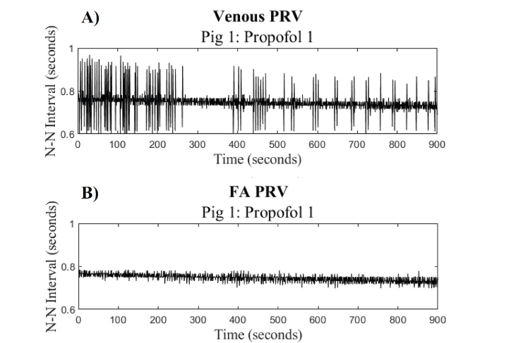 Figure 4: Comparison of HRinst for Venous and FA signals: A.) The venous PRV (pulse rate variability) signal and B.) the FA (femoral artery) pulse rate variability signal for porcine subject 1 during Propofol 1.