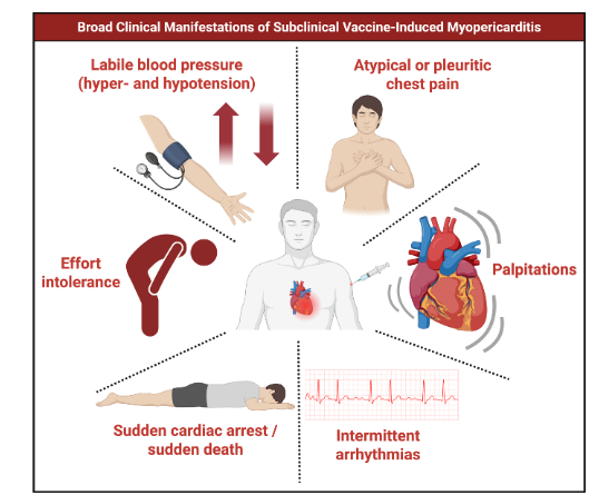 Figure 1. Broad Clinical Manifestations of Subclinical Vaccine-Induced Myopericarditis. This figure illustrates the broad spectrum of clinical manifestations associated with subclinical COVID-19 vaccine-induced myopericarditis. Unlike overt cases, affected individuals typically lack obvious symptoms such as severe chest pain or dyspnea. Instead, more subtle cardiovascular signs may appear, including atypical or pleuritic chest pain, palpitations, intermittent arrhythmias, labile blood pressure with both hyper- and hypotensive episodes, and effort intolerance. In certain cases, the first clinical presentation may be catastrophic, with sudden cardiac arrest or sudden death representing the most severe end of the continuum. These features underscore the importance of proactive screening and surveillance to identify subclinical cases early and prevent life-threatening outcomes.