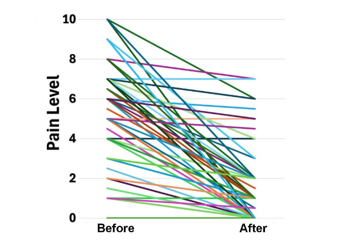Figure 2. Individual plots of self-reported pain levels from 72 migraine and trigeminal neuropathy subjects collected at onset of trial (BEFORE) and at termination of a baseline period of no vibration at the end of the vibratory trial (AFTER).
