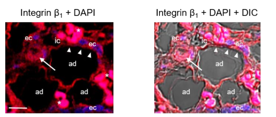 Fig. 4. CLSM fluorescence image of integrin β1 in the same biopsy (thigh). Integrin β1 subunit is immunolocalized around the mature adipocytes (ad) that are in close proximity to the small blood vessels (arrowheads) containing microthrombi (arrow), as well as in the luminal ECs (ec) and some immune cells (ic). Blue, nuclear DAPI staining; DIC, differential interference contrast image; red blood cells (asterisk). Scale bar: 35µm.