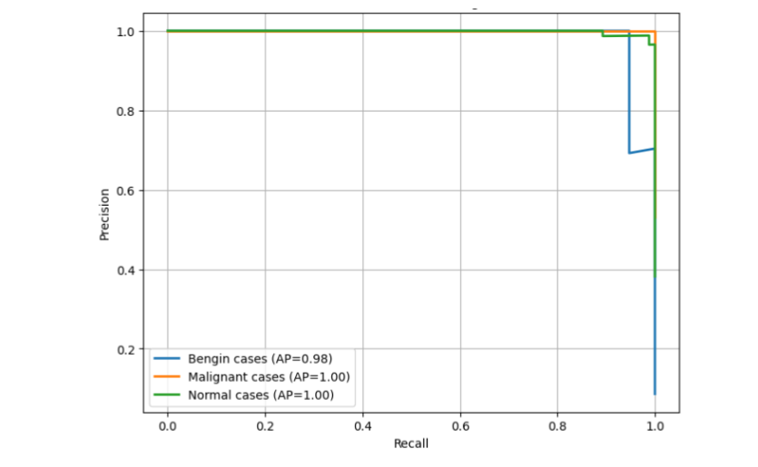 Precision-Recall Curves Across Lung Cancer Classes.