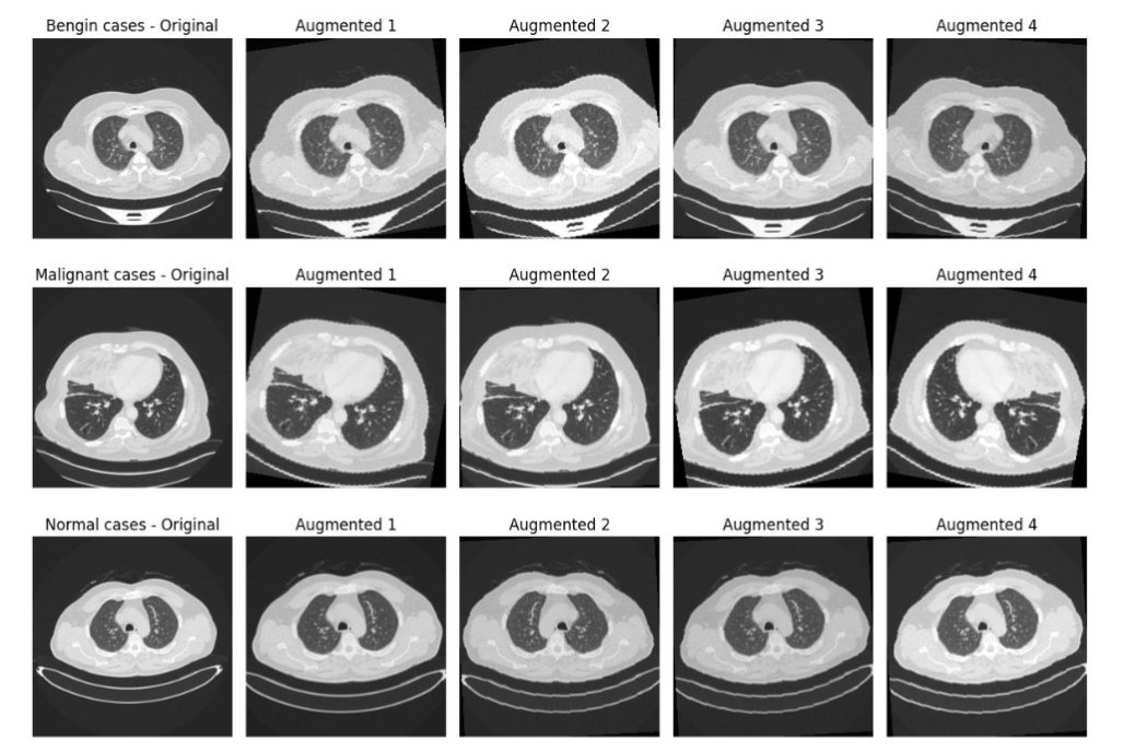 Data Augmentation Results Across Cognitive Conditions.