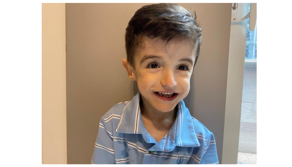 Photo of child with mild dysmorphic features including mild down slant palpebral fissures, thin upper lip and mild borderline posteriorly rotated, low set ears.
