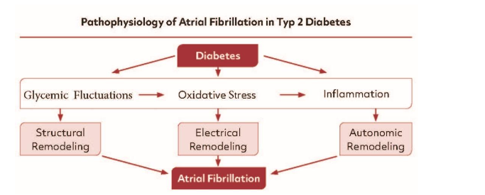 Pathophysiology of Atrial Fibrillation in type 2 Diabetes. Diabetes mediated Atrial Fibrillation is multifactorial encompassing Structural, Electrical and Autonomic Remodeling, Metabolic Dysfunction, Oxidative Stress and Inflammation.