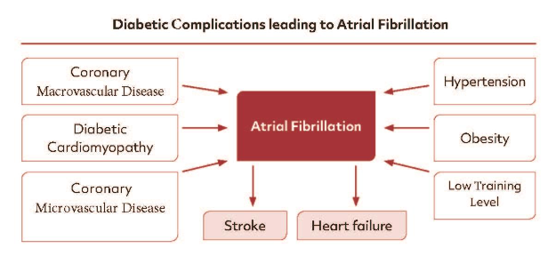 Diabetic Complications leading to Atrial Fibrillation are macrovascular coronary artery Disease, Diabetic Cardiomyopathy and Microvascular coronary artery Disease. Additionally, also noncardiac factors are known to favour the Induction of Atrial Fibrillation like Overweight, Hypertension and a Low Training Level. Potential complications of Atrial Fibrillation are stroke and heart failure.